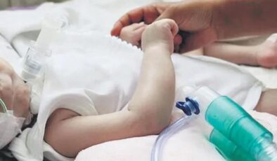 SMA’lı hasta sayısı azaldı